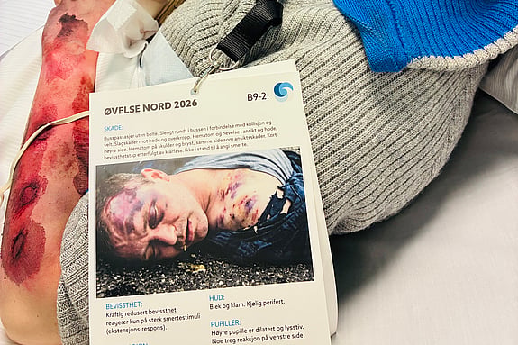 Skådespelare med skada. Foto: Privat